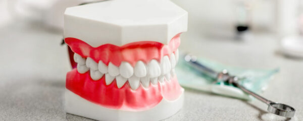 prothèse dentaire